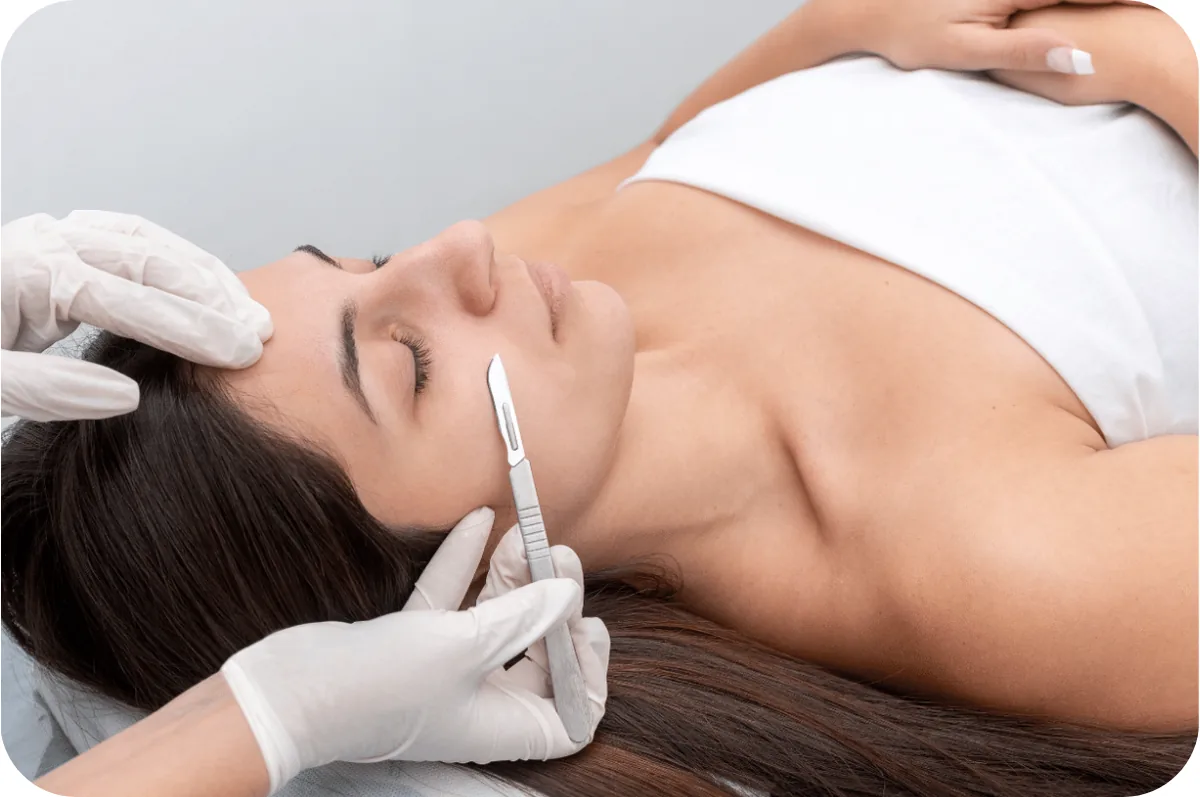 Tratamiento de Dermaplaning en Divay Estética, Los Olivos