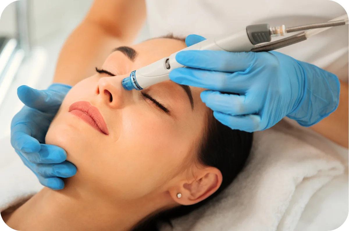 Tratamiento Hidrafacial en Divay Estética, San Juan de Lurigancho