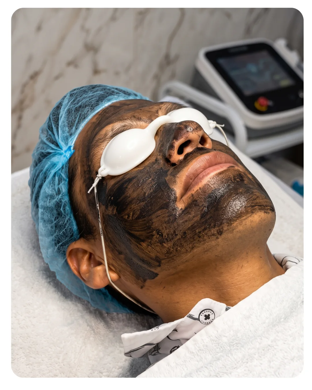 Sesión real de Hollywood Peel en Divay Estética