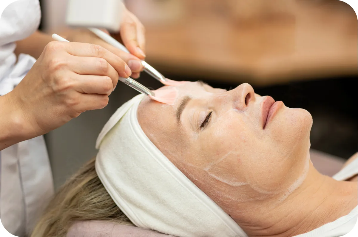 Peelings faciales en Divay Estética, San Juan de Lurigancho